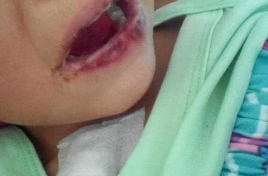 DEPLORABLE, ENFERMERA LE DA REFRESCO CON ÁCIDO A SU HIJASTRA