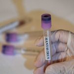 (BRASIL) AUTORIDADES SANITARIAS CONFIRMAN UN FALLECIMIENTO POR HANTAVIRUS EN MINAS GERAIS