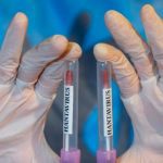 (MUNDO) OMS EMITE ALERTA SOBRE RIESGO DEL HANTAVIRUS