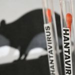(VENEZUELA) CONFIRMAN FALLECIMIENTO DE 3 CIUDADANOS POR HANTAVIRUS EN EL ESTADO ANZOÁTEGUI (+COMUNICADO)